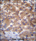 UBE2NL Antibody (N-term)